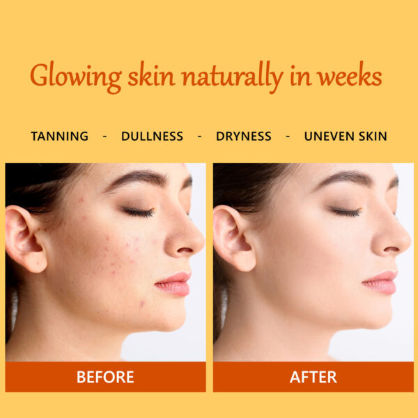De-Tan Glow Night Cream Ubtan with Power of Serum | Tan free, Brightening, Pigmentation, Skin renewing, Sleep treatment (50 g) - Image 4